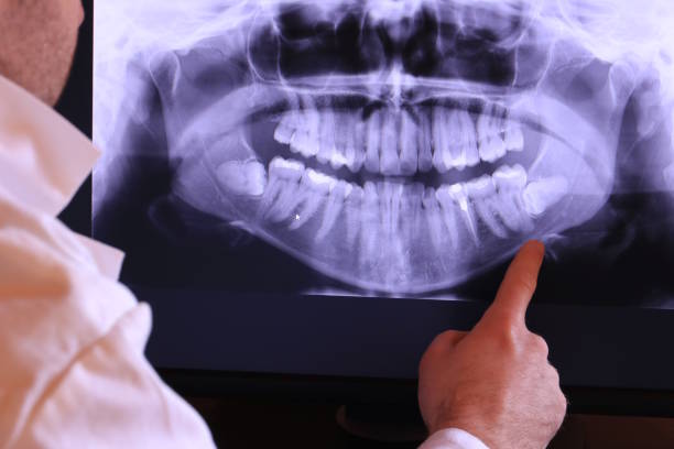 Best Tooth Pain Emergency Relief  in Garden Grove, CA