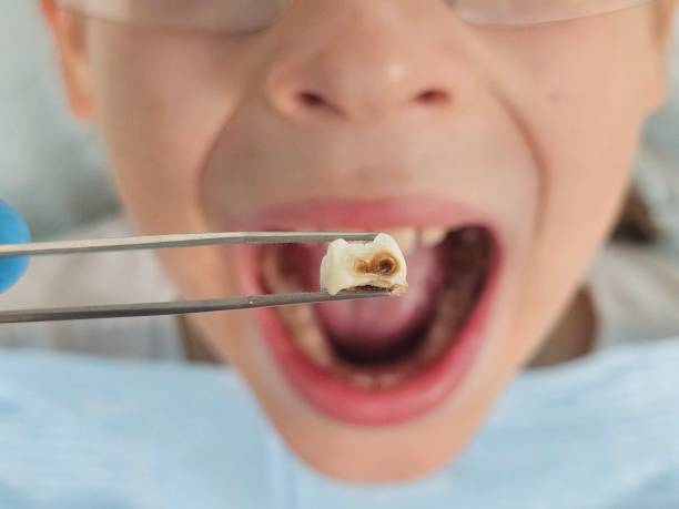 Best Knocked-Out Tooth Emergency  in Garden Grove, CA